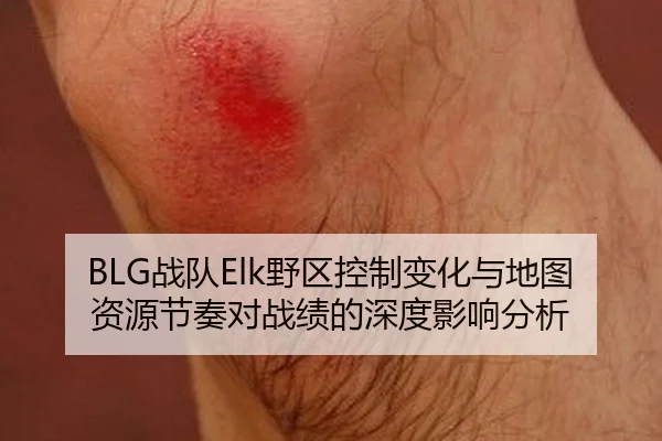 BLG战队Elk野区控制变化与地图资源节奏对战绩的深度影响分析